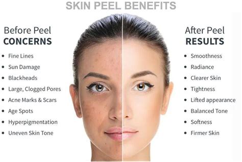 how many glycolic peels to see results|What You Need to Know About Glycolic Acid Peels .